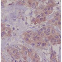 DAP Kinase 1 Rabbit mAb