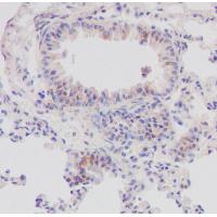 C1QBP Rabbit mAb