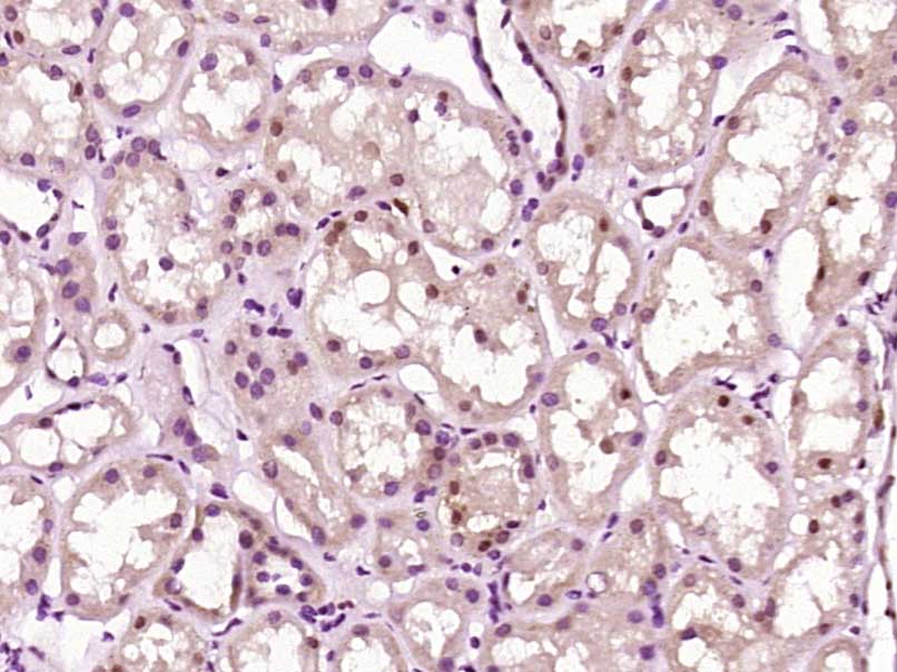 ZNF687 Antibody