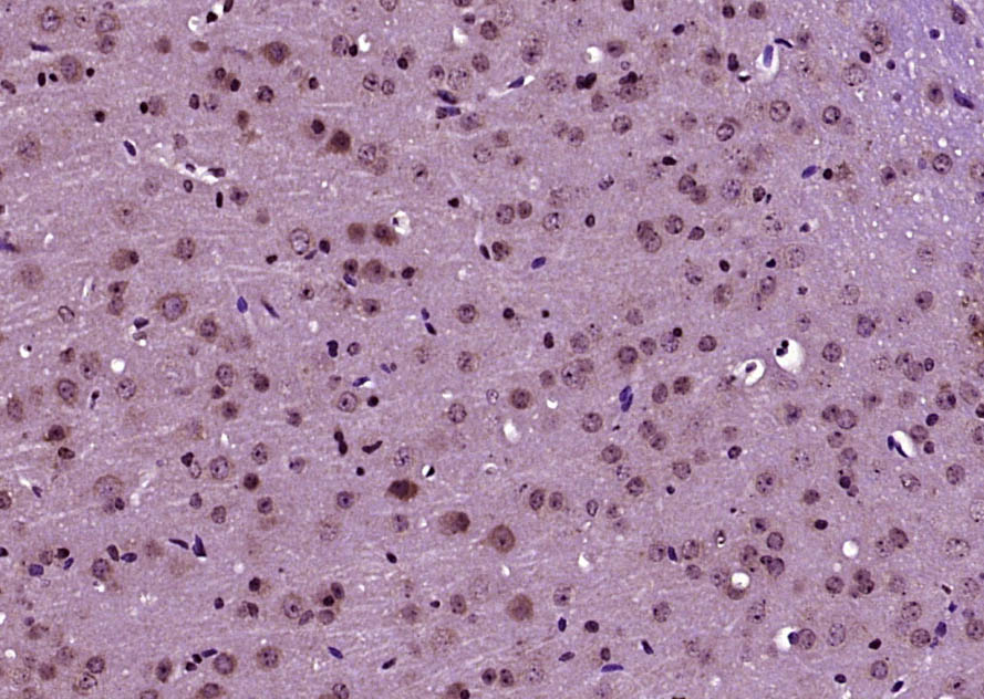 GLS1 antibody