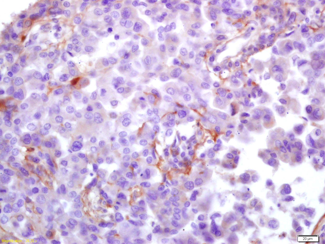 Cytomegalovirus pp65 antibody