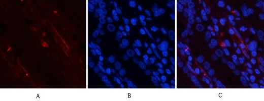PI 3 kinase p85/p55 (Phospho Tyr467/199) Antibody