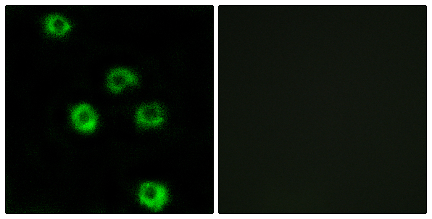 Latrophilin-2 Antibody